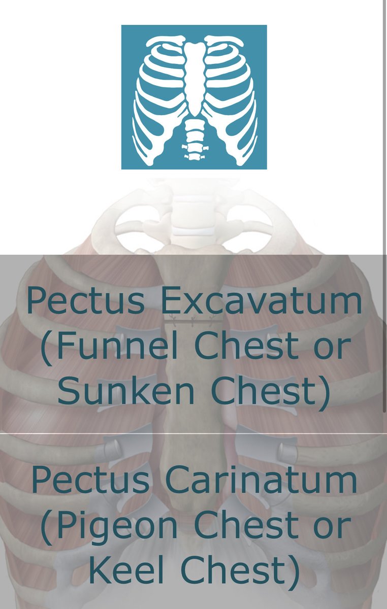 Upload our free app on management of chest wall deformities #pectusdeformities #chestwallsurgery #pectusclinic