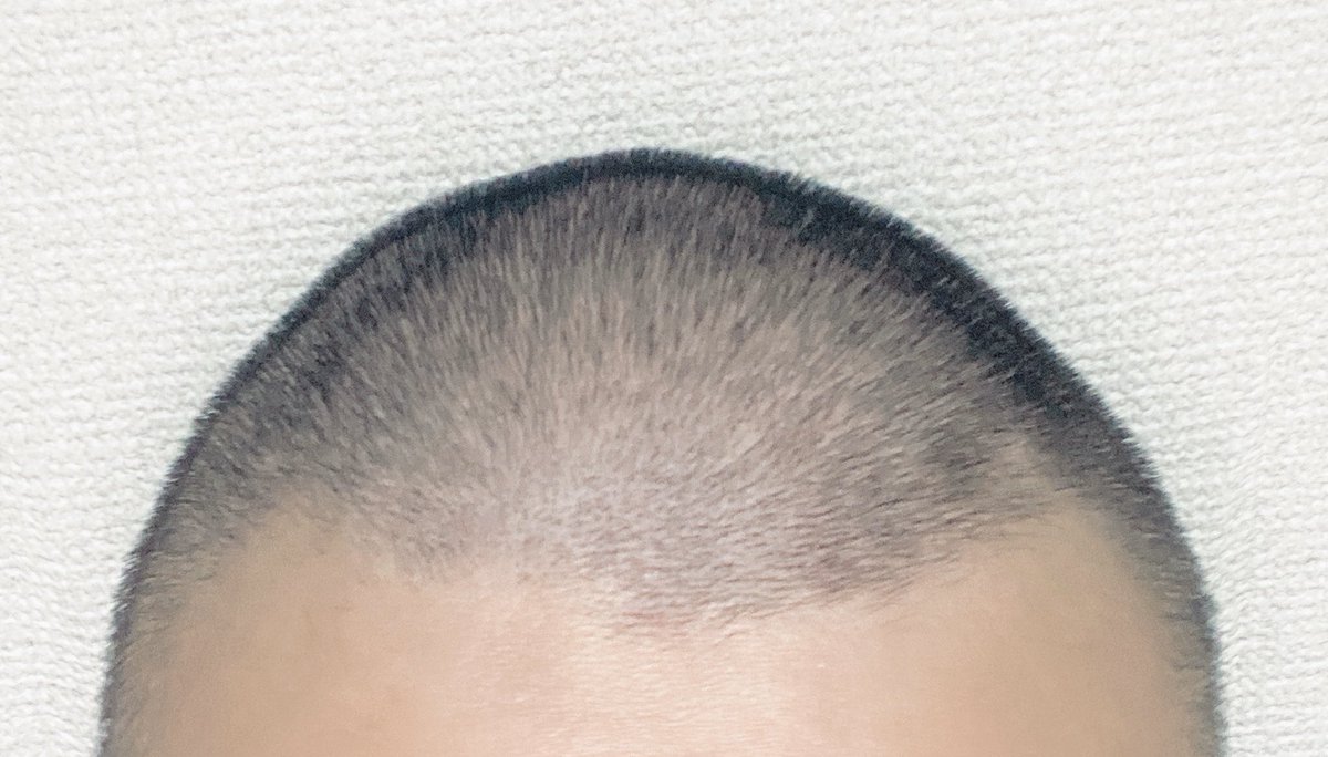 南ボッキーナ 奥田民生になりたいボーイだから 09年ごろからずっと本家と同じ 坊主ちょい伸び にしてた 最近は民生さんがアフロになったから 俺も極度の癖っ毛を活かして髪を伸ばすことにチャレンジしてみたけど違和感maxでついに剃ってしまった