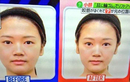 輪ゴムを巻くだけ！誰でも手軽に小顔を手にいれる方法をどうぞ。