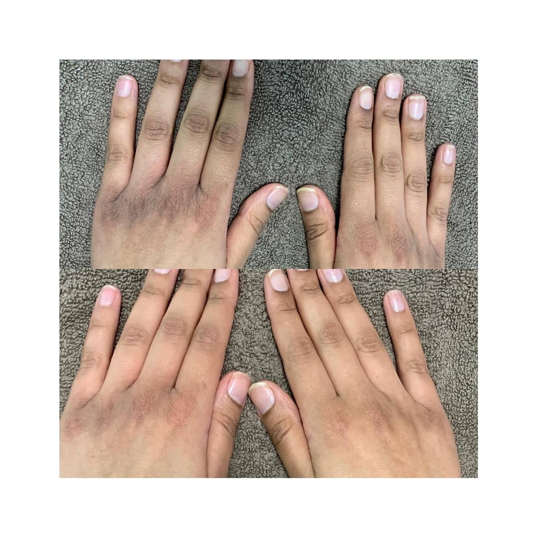 OpAestheticsRT's tweet photo. My hand treatments moisturise &amp; hydrate dry hands. If you are suffering in the colder months book in for a hand treatment today😁. Visit https://t.co/h2Tq0hm8uD to book💅🙌

#Skin #Handtreatment #Handmasage #skincare #Dermatologynurse #dermatology #Consultation #LipFiller #clinic https://t.co/DPX8hBSGDL
