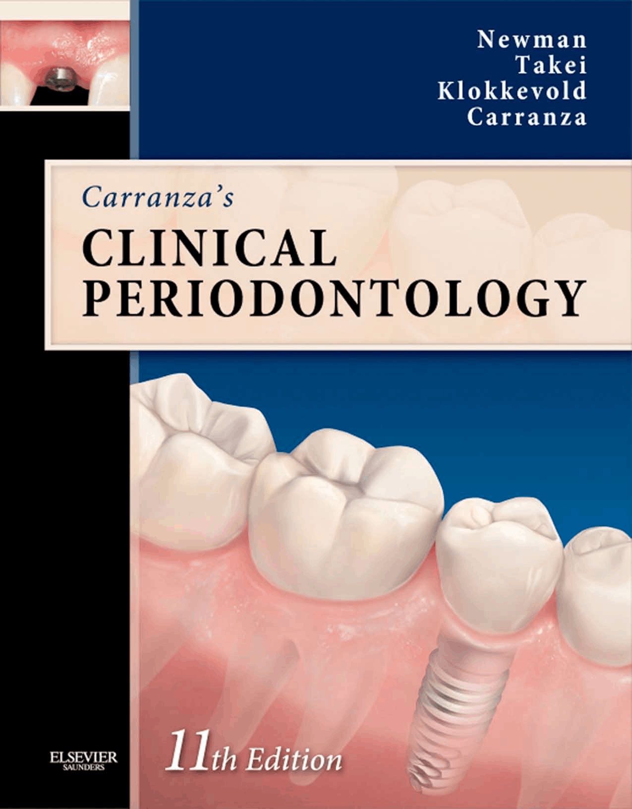 Dr.Haif AlQahtani on Twitter: "📌(#SDLE) Carranza's Clinical Periodontology  11th ed https://t.co/VnB9IazGC0 Carranza's Clinical Periodontology 9th ed  https://t.co/o0KmXImP8p https://t.co/Is7ROCHj1k" / Twitter