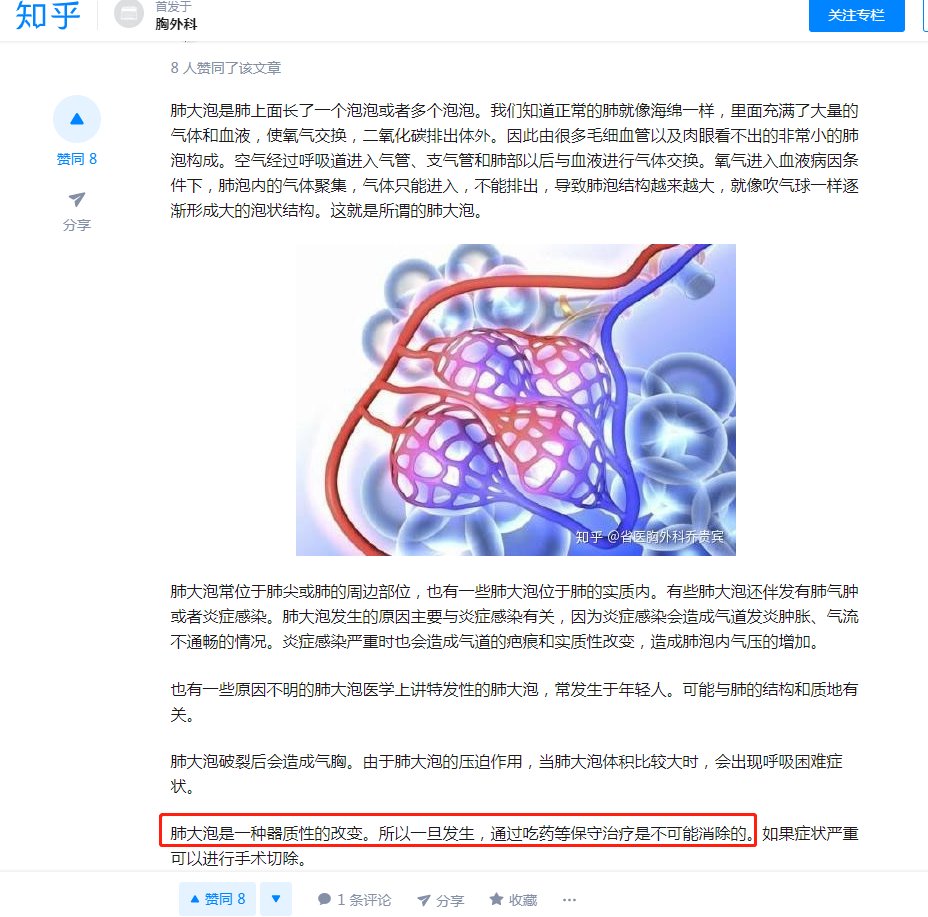 财经真相on Twitter 武汉肺炎后遗症 肺大泡 肺 大泡是一种器质性的改变 所以一旦发生 通过吃药等保守治疗是不可能消除的 如果症状严重只能进行手术切除 Ps 现在明白为何中共官媒报道说 换肺 案例了 问题是谁有能力可以换正常人的肺 财经真相on Twitter 武汉肺炎后遗症 肺大泡 肺 大泡是一种器质性的改变 所以一旦发生 通过吃药等保守治疗是不可能消除的 如果症状严重只能进行手术切除 Ps 现在明白为何中共官媒报道说 换肺 案例了 问题是谁有能力可以换正常人的肺