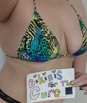 RT @BikinisForCure Lobular carcinoma is a very common, but not the most common type of breast cancer ow.ly/PFt850yKVkD #breastcancer #lobularcarinoma