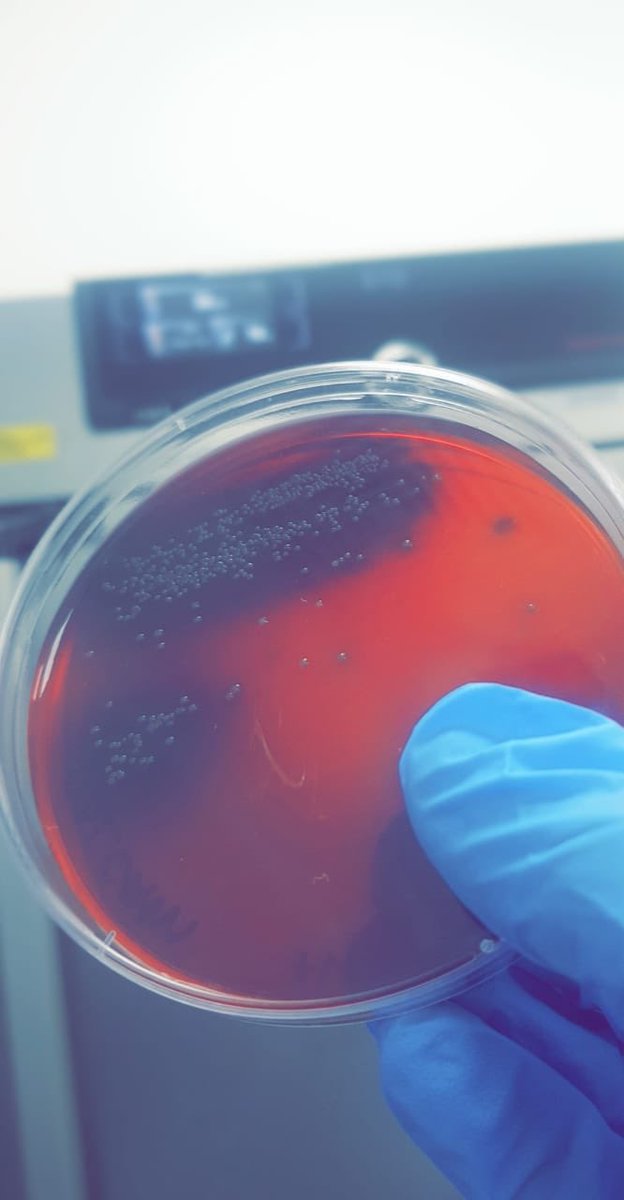 AMAN_ISolutions's tweet image. Listeria Spicies in palcum agar.
سلالات اللستيريا في اجار بالكوم

#AMANLAB #MICROBIALTESTING #FOODSAFETY