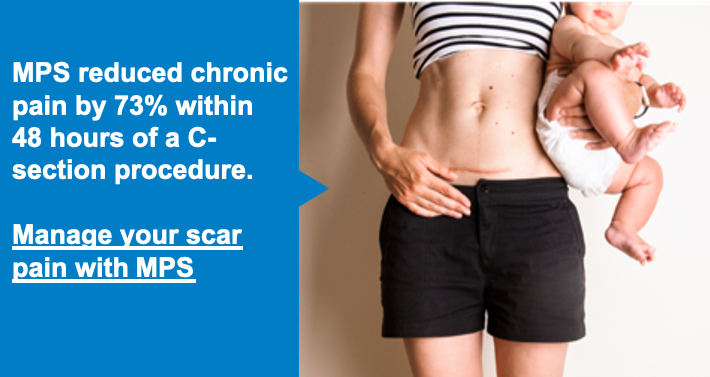 Dolphin_NS's tweet photo. MPS reduced chronic pain by 73% within 48 hours of a C-section procedure.
Manage your scar pain with MPS:
https://t.co/cDrJOobIyV
#DolphinMPS #Wellness #PainRelief #CSection #Surgery #NewMom #WomensHealth https://t.co/6ulvfaHfRa