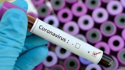 eldiarioec's tweet photo. 🔴#ATENCIÓN 
Se confirma el primer caso de #coronavirus en #Manabí, con este registro la cifra de infectados en #Ecuador asciende a 58. El cerco epidemiológico es de 273 personas. https://t.co/6hwXnhS5fn