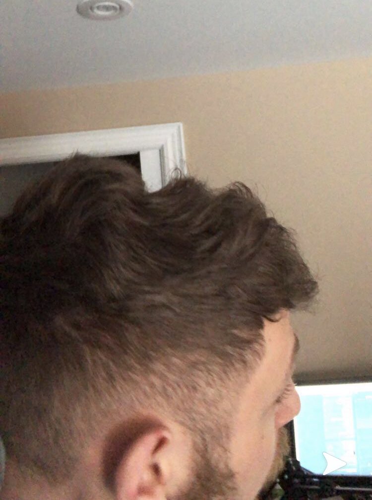 Luka Doncic Fan Accou This Is My Tryhard Headset Hair After A Sexy Fucking Girl With Milk Asks For Couple Chill Arams