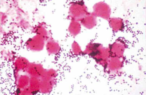 #MRSA: What wound care professionals need to know ht.ly/QsM830qqi6V 
This dangerous pathogen has extended beyond the hospital to become an even greater threat.
#woundcare #HCM