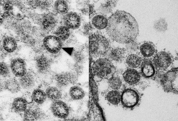 Başımızın belası tanıyabildiniz mi? #Covid_19 #coronavirus #coronavirus #evindekaltuerkiye #coronavirus #CoronavirusOutbreak #COVID #CoronaParty