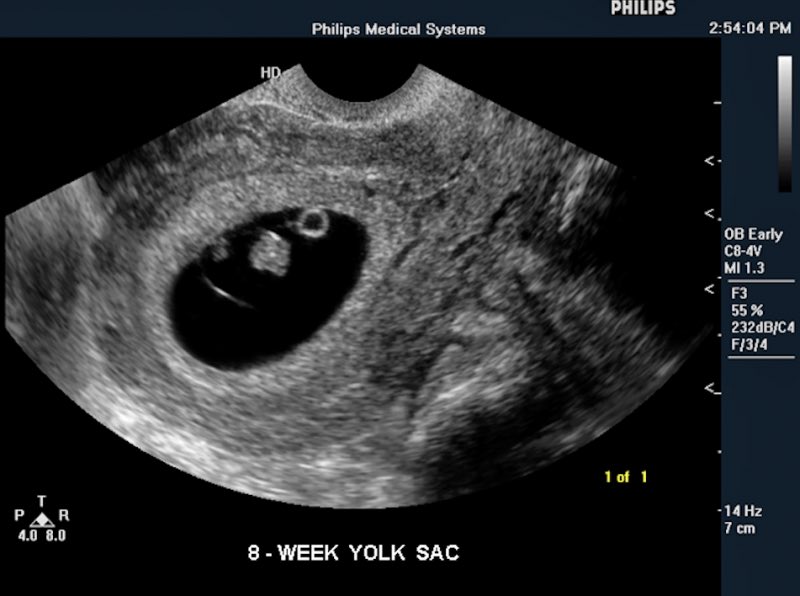 ChristyMacMack's tweet photo. Happy Monday and happy #MCM to my handsome king and fiancé @KingAndreISO but most of all the father to my little nugget, I just found out I’m expecting. https://t.co/zTLWT04TjM