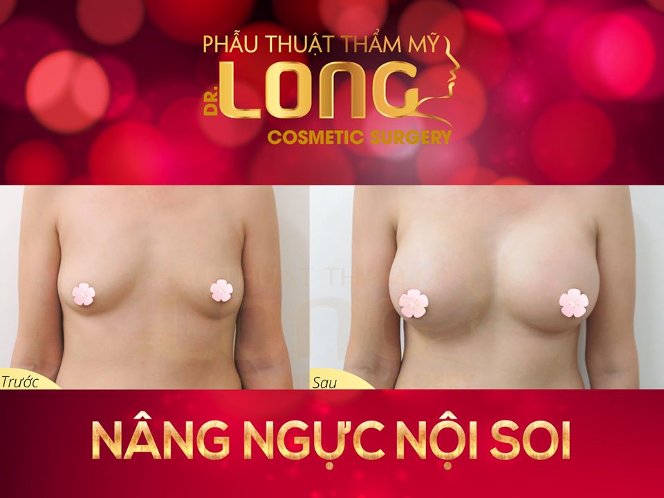 TMVBsLong's tweet photo. 🤤🤤#TƯ_VẤN_NÂNG_CẤP_VÒNG_1_NHÌN_MÀ_HAM🤤🤤
📌PKCK PTTM Bác sĩ Long
📌ĐC: 518 Lê Hồng Phong, P.1, Q.10, TP.HCM
📌Hotline: 0908 493 008
📌Website: https://t.co/yzw3wluLJH
📌Youtube: https://t.co/HR6otAbe7u
❌#Đã_Tốn_Tiền_Làm_Đẹp_Thì_Hãy_Tốn_Tiền_1_Cách_Xứng_Đáng https://t.co/hEBgnidE4m