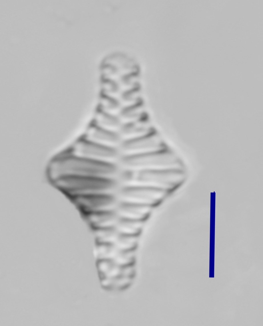 UkumariSerrepe's tweet photo. Staurosirella leptostauron (Ehrenb.) D.M.Williams and Round 1987, vista valvar. Escala de la barra = 5 µm. Common species in shallow water at higher pH values. #FossilDiatoms #JuninLake #Chinchaycocha #MIS5 https://t.co/Ab8EOHi6gf