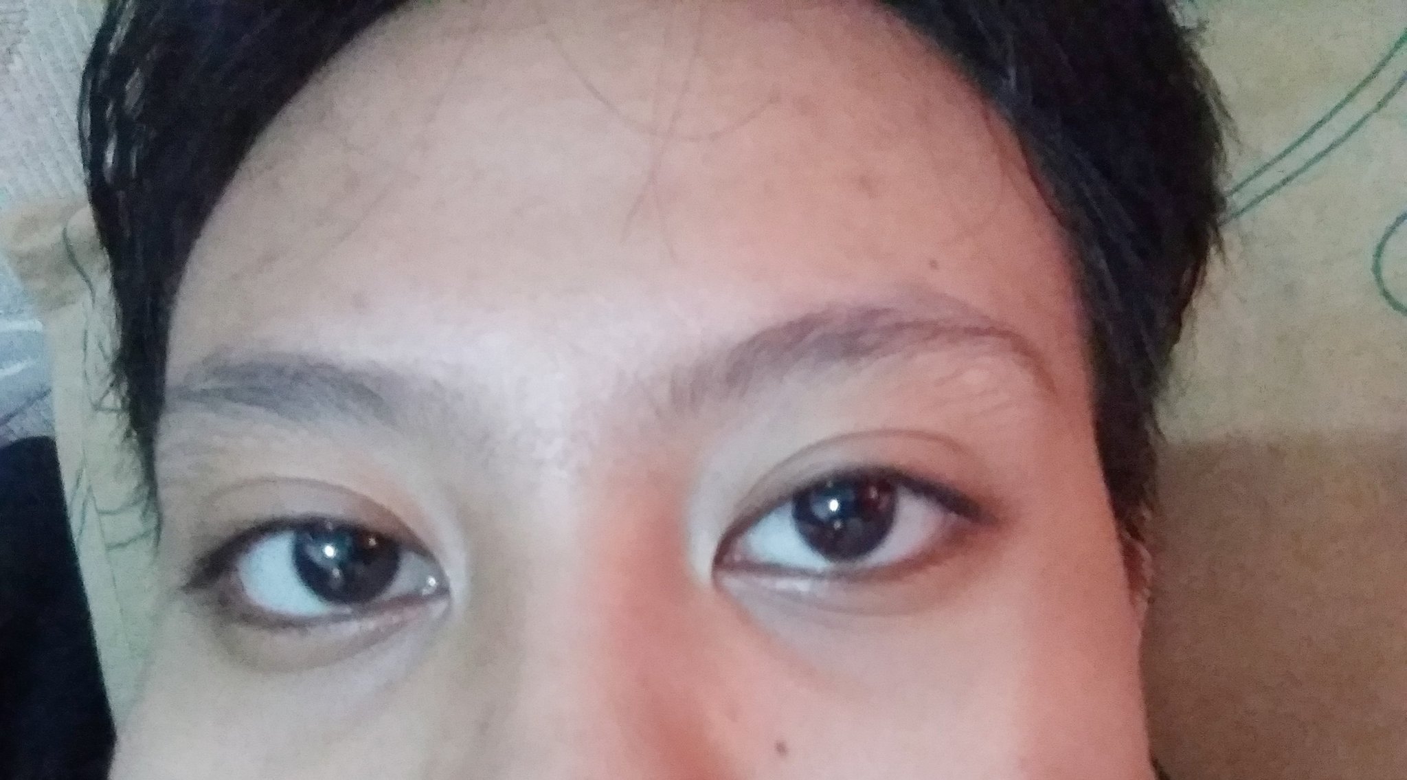 Beauty Menfess On Twitter Beauty Cara Menghilangkan Kerutan Di Bawah Mata Dan Garis Di Samping Hidung Gmn Ya Kak Umurku Baru 16 Thn Thanks Before Https T Co Vswttbu3wx Twitter