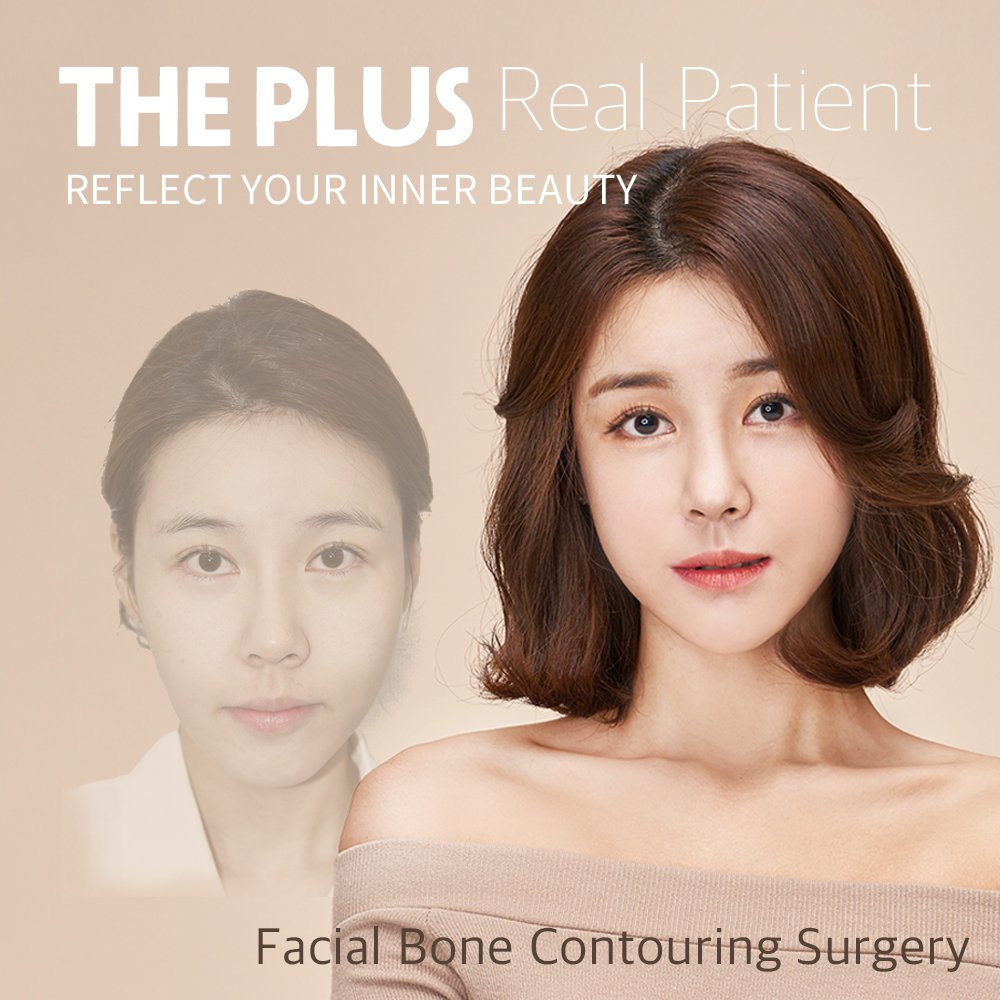 theplusps's tweet photo. Feel Confident &amp; Proud from every angle!
#THEPLUSPlasticSurgery #FacialBoneContouring 
Achieving an optimal harmony of facial bones,muscles and fat with THE PLUS will provide natural and long-lasting results. 
 #Sinsa #Gangnam #GangnamPlasticSurgery #BoardCertifiedPlasticSurgeon https://t.co/jE3E0jmC4a