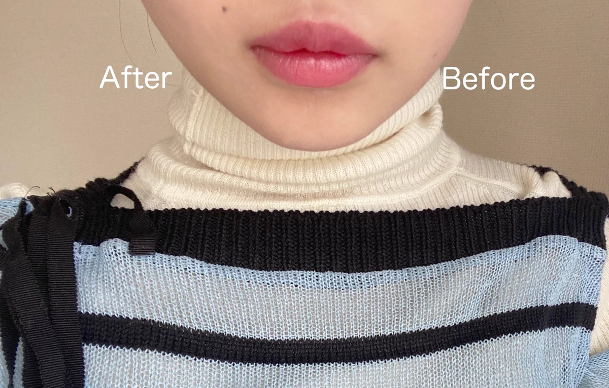 顔にドライヤーをあてた結果？小顔になったwww