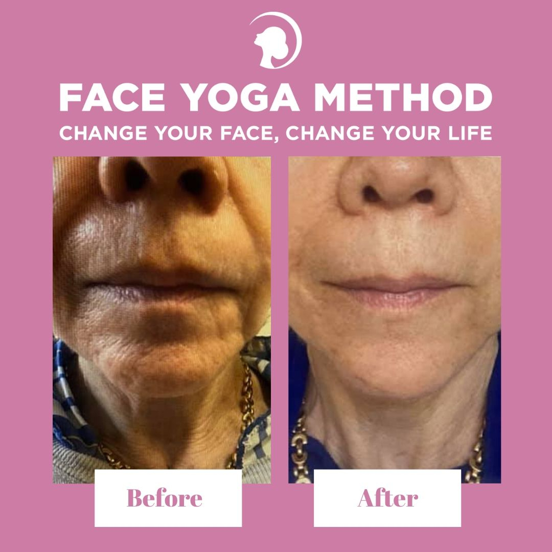 FaceYogaMethod's tweet image. 🔥 #TRANSFORMATIONTUESDAY 🔥

Look at this incredible transformation from one of our Bootcampers Bonnie! 👏👏👏

The photo on the left is from January 11th and the one on the right is from March 8th. 🤯

Ready for your transformation? 🙋🏻

soo.nr/vIYn