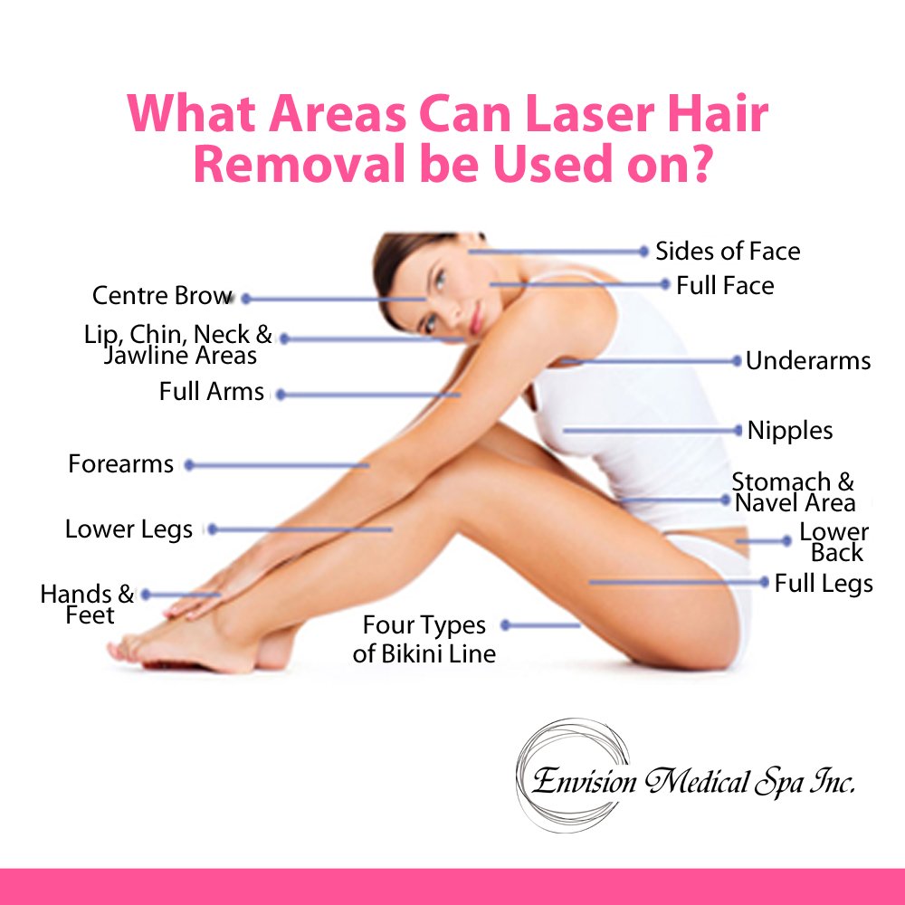 EnvisionLeduc's tweet photo. Do you have unwanted hair on your face or body? We can help with Syneron Gentle Max Pro hair removal system. Give us a call for more information.
#LeducBusiness #LeducSpa #LeducClinic #Syneron #HairRemoval https://t.co/sZGZUjuXOD