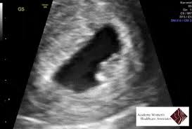 So tire
<a href="/WWEAmbroseChamp/">Dean Loves Dakota</a> 
 The babie is making me tired