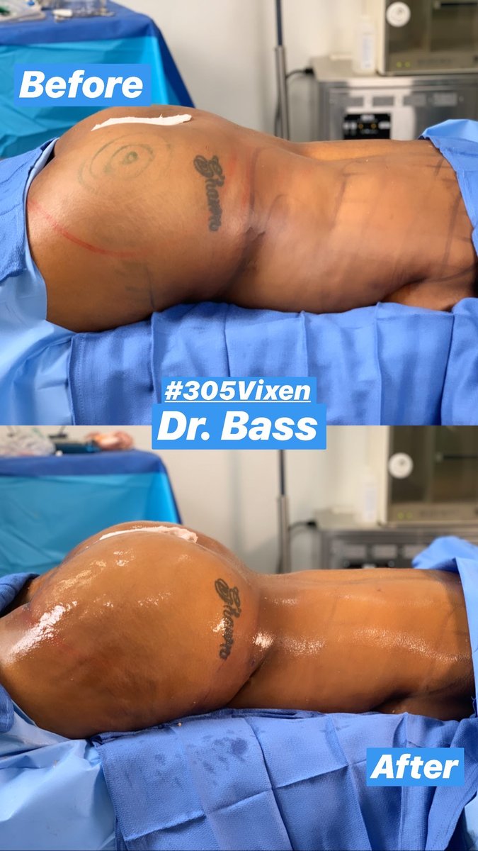 305 Plastic Surgery 305surgery Twitter