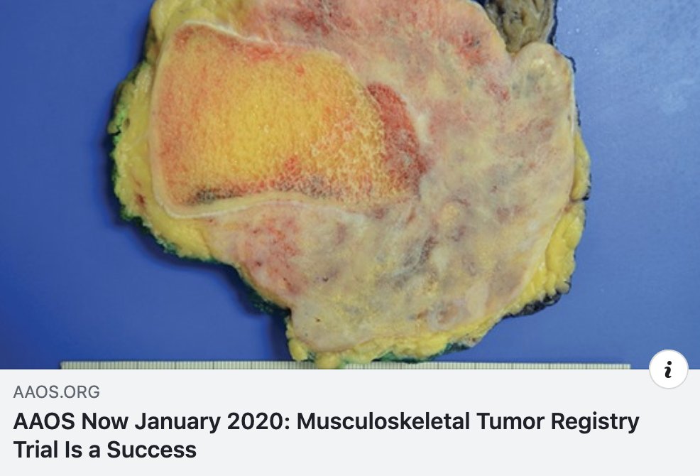 aaos.org/aaosnow/2020/j…