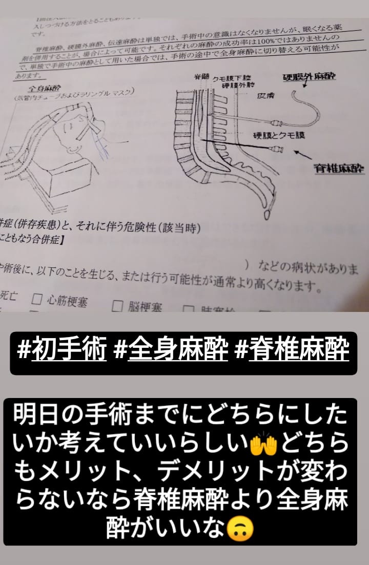 脊椎麻酔 脊椎麻酔