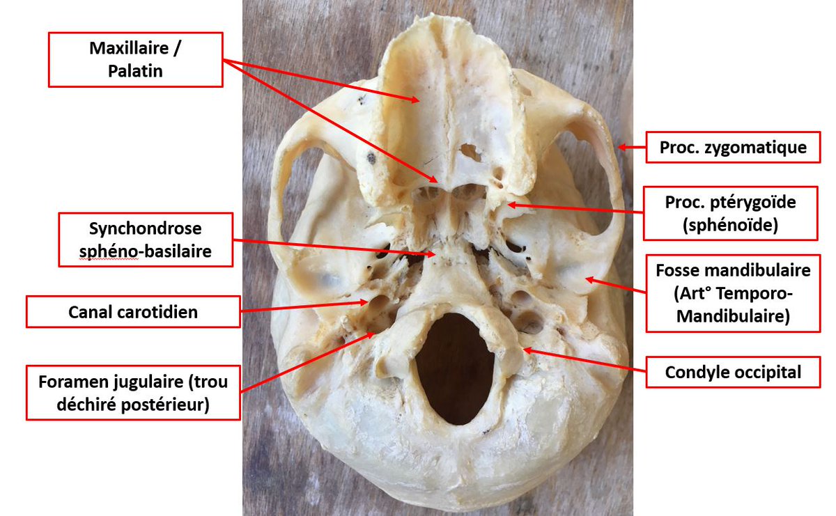 AnaMorphoSci's tweet image. Nous sommes asymétriques dans notre symétrie ! #anatomie
Observez, sur ce crâne en vue inf., les asymétries droite/gauche des éléments que j'ai pointés. L'orientation des trous, les conformations des surfaces articulaires, l'ossification sphéno-basilaire.
Cela est NORMAL. ⤵️