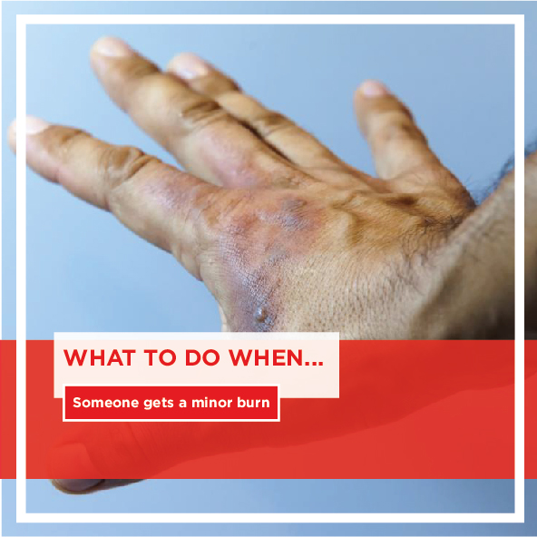 GauMed911's tweet photo. Follow us on Facebook or Instagram to find out some immediate steps to take for a minor burns:

Instagram: https://t.co/qjpNlhqFEt 
Facebook: https://t.co/ZcweThdm3S

For emergency medical assistance call - 087 365 2087

#safetyfirst #savinglives #CommunityComesFirst #Burns https://t.co/iX1UqCB5xZ