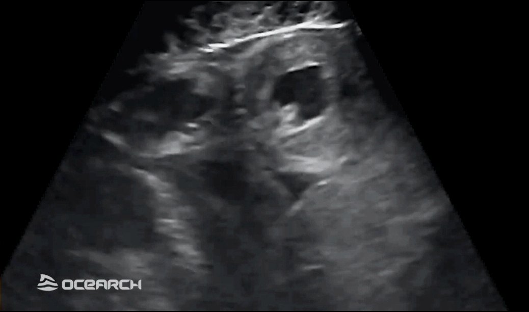 linds4fins's tweet photo. @SharkMontauk @OCEARCH Hello my #FinFriend! I'd be happy to try and help answer your question! That is an ultrasound machine! It can show scientists pictures of what's going on inside your body. Molly was able to see a white shark heartbeat! But you can also use it to look at reproductive organs. https://t.co/7JeKOkVVWi