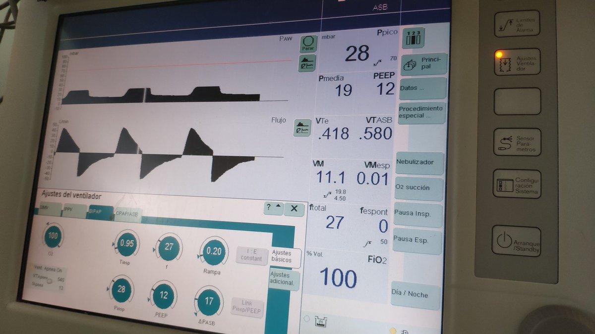 Ayer extubamos a nuestra primera paciente con neumonía bilateral Covid19: mejoró mucho y se le quitó el tubo porque ya no necesitaba ventilación mecánica.
Hoy se va de alta de la UCI a la planta respirando bien, sonriendo y dando las gracias #Sepuedecurar #TodoVaASalirBien 🙌🙌🙌