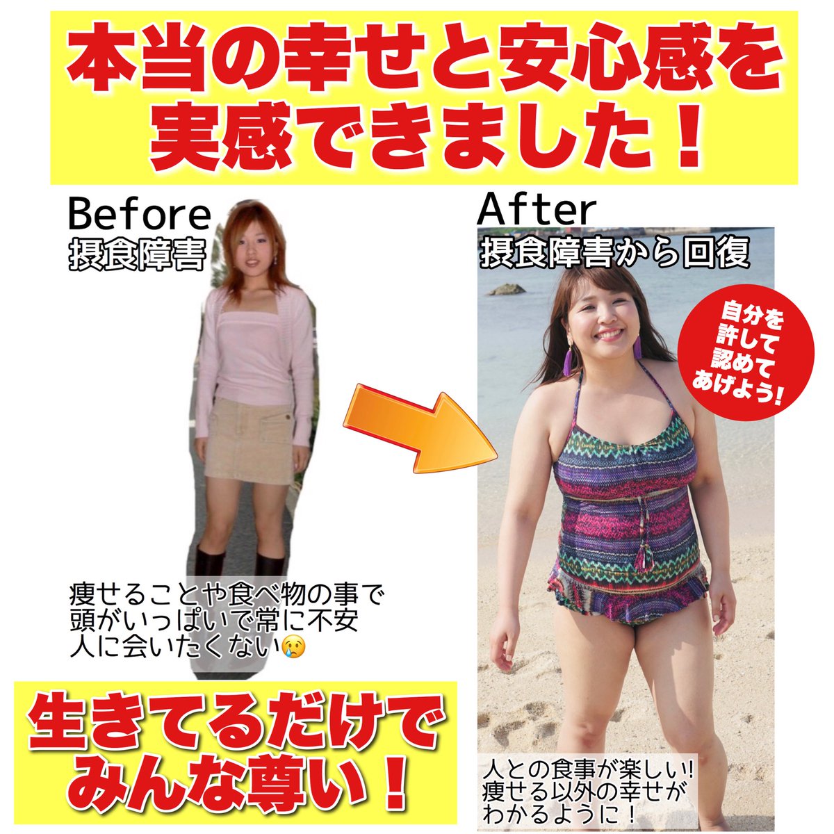 摂食障害を克服して激ヤセ状態を脱却した人が作った 逆ダイエット広告 が話題に Afterの方が魅力的 一日中カロリー気にしてる方が不健康 Togetter