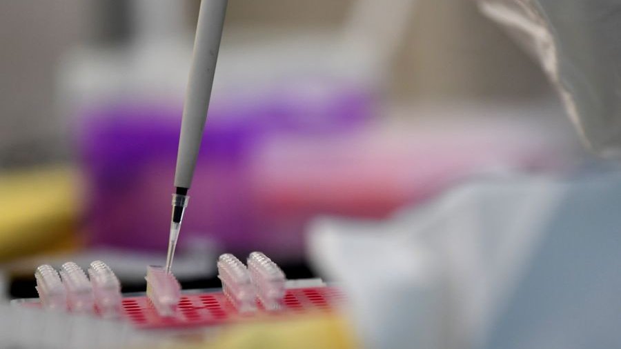 globaltimesnews's tweet photo. If the novel #coronavirus is a Chinese virus, HIV is an American sex virus, syphilis is American treponema pallidum, Spanish flu is American flu: prominent Chinese scientist Rao Yi @realdonaldtrump https://t.co/DyoBWuVGrY