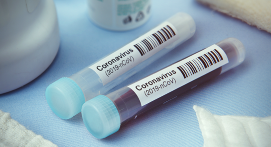 “The California Dental Association strongly recommends that dentists practicing in California voluntarily suspend non-urgent or non-emergency dental care for the next 14 days. ” cda.org/Home/News-and-…