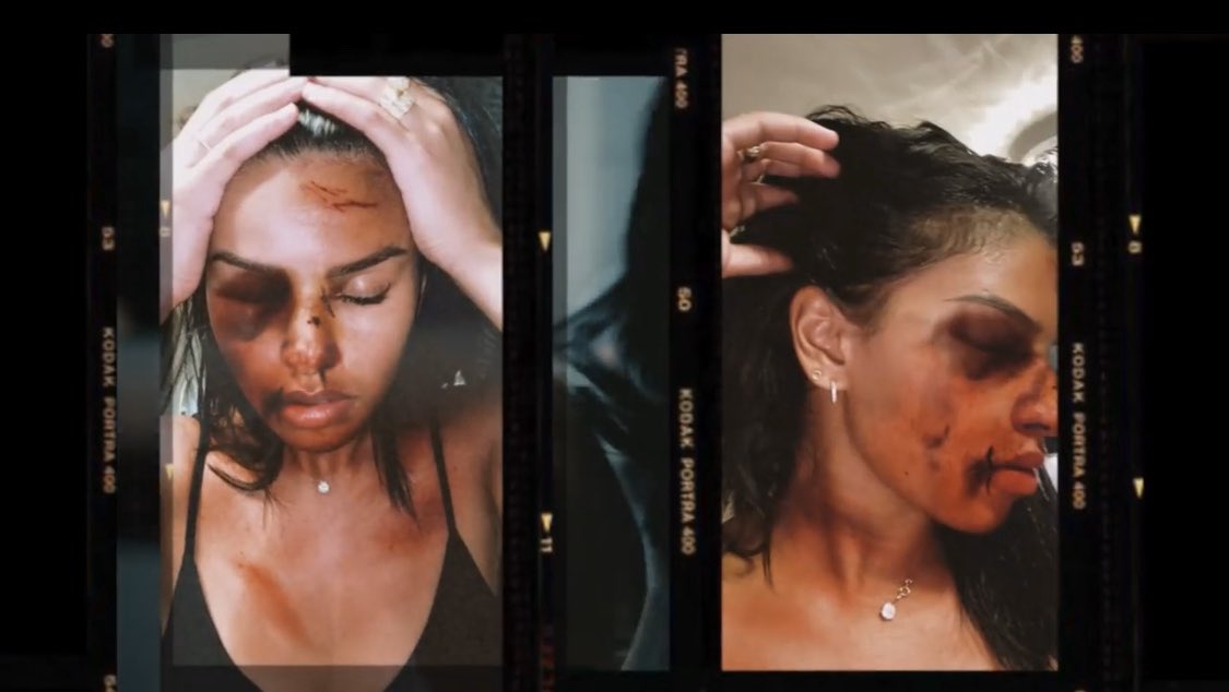 Jihxnee's tweet photo. Le clip d’Imen Es, tellement triste quand on sait qu’il reflète la vie quotidienne de milliers de femmes. Facile à dire, peut-être pas à faire mais seule solution possible : FUYEZ ! Ne faites surtout pas l’erreur de vous dire « il ne recommencera pas » parce qu’il RECOMMENCERA. https://t.co/kjwIZxcndj