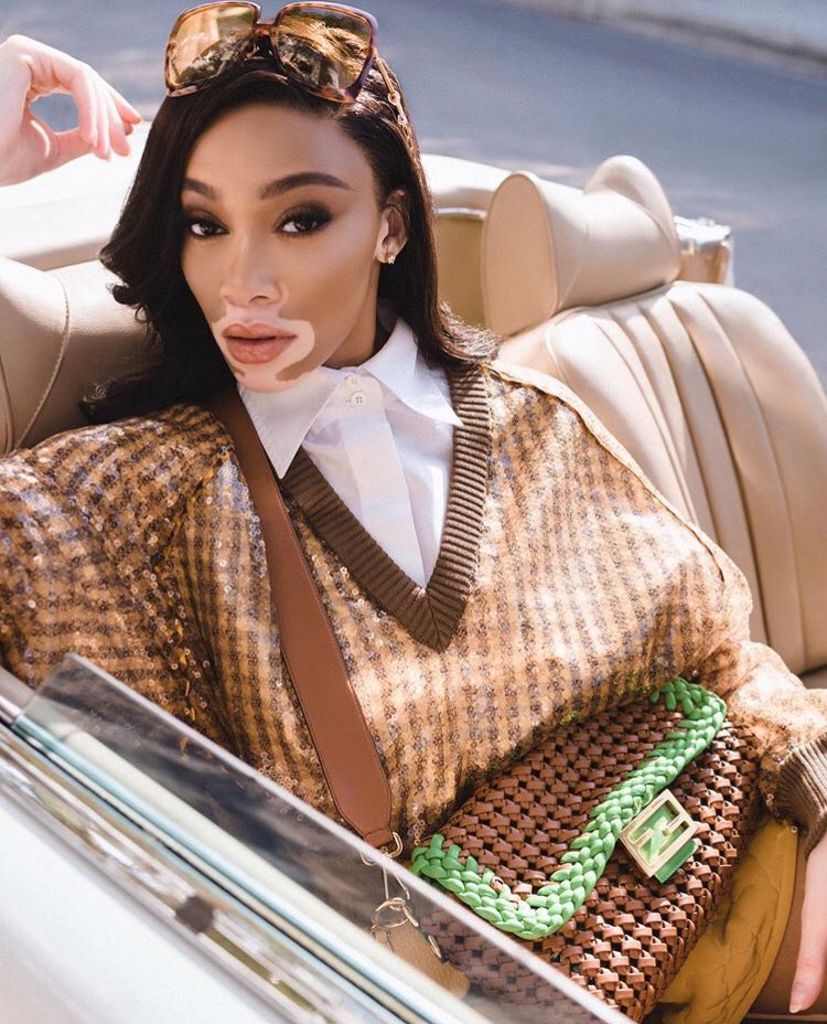 ceeyline's tweet photo. #WinnieHarlow pour la couverture du Grazia Italie 🔥😍 https://t.co/dP4xc0Qqw2