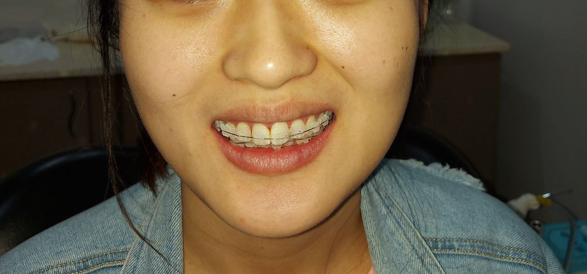 Pristine Smile By Dental Collaborations Pristinesmiledc Twitter