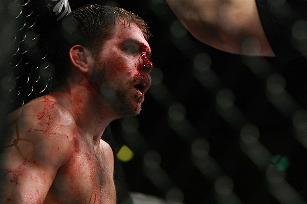 IIIMIII_'s tweet photo. ظهوره الأول الأول كان في عرض (#UFC135) ولكن هذه المرة في "الوزن الخفيف" واجه حينها المقاتل "آرون رايلي" وتمكن توني من الإنتصار بعدما حطم فك رايلي مما جعل الحكم يوقف النزال.
- رابط النزال ( https://t.co/75vfng3O4q ) https://t.co/cYxkp3cWg2