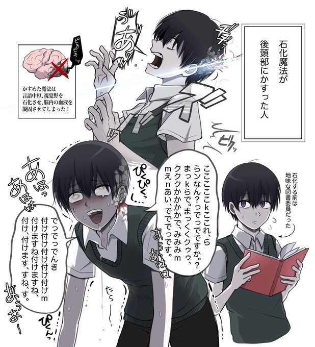 石化魔法が後頭部にかすった人 