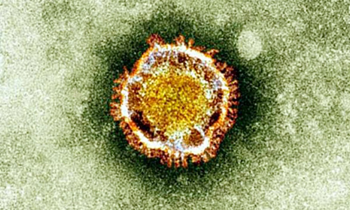 BFMTV's tweet photo. EN DIRECT - Coronavirus: 767 morts en Espagne, 30% de plus en seulement 24 heures
https://t.co/PDgST4L8yp https://t.co/E17ArfT1Rp