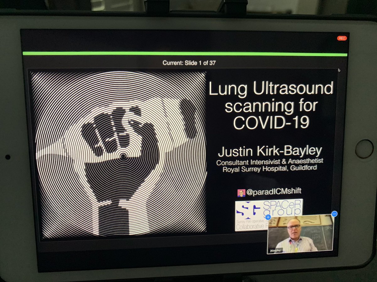 amit_pawa's tweet photo. Once again - indebted to @PARADicmSHIFT via @GSTTanaesthesia and remote #POCUS TEACHING for #lung #Ultrasound #LUS https://t.co/4IJEQsPKz4
