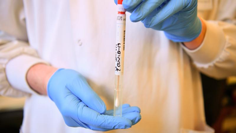 BelTel's tweet image. #coronavirus : Two Northern Ireland firms are selling Covid-19 tests around the world but no orders from NHS
belfasttelegraph.co.uk/news/health/co…