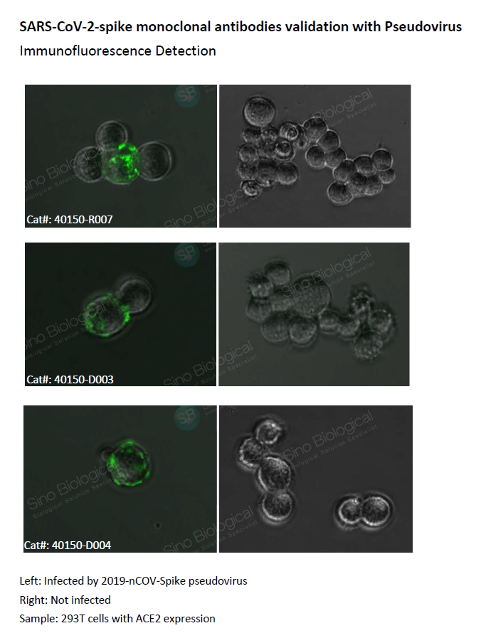 Sino_Biological's tweet photo. Our SARS-COV-2-Spike monoclonal antibodies are validated with Pseudovirus in Immunofluorescence. Check them out here: https://t.co/iuUI3tFnOl
#SinoBio #SARSCoV2 #COVID19 #coronavirus #antibody #reserach #biotech https://t.co/ON8u92bEC0