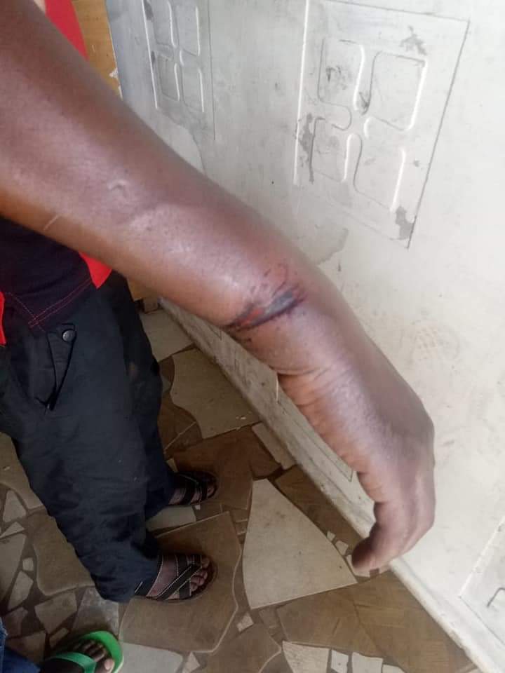 patricksafariR's tweet photo. This guy was handcuffed for four days at kilome police station.
We cannot allow this under whatever circumstances.
@IPOA_KE @NPSOfficial_KE https://t.co/KC9KKJPMd1