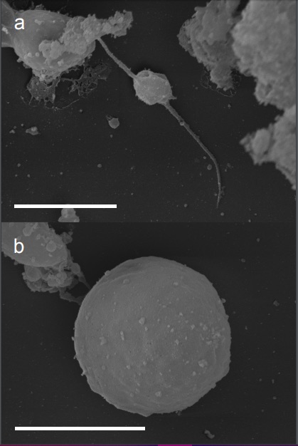veupathdb's tweet image. Characterization of Cystoisospora suis sexual stages in vitro - and check out the genome in #ToxoDB  researchsquare.com/article/rs-100…