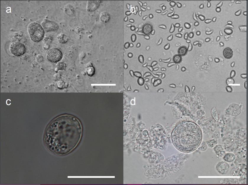 veupathdb's tweet image. Characterization of Cystoisospora suis sexual stages in vitro - and check out the genome in #ToxoDB  researchsquare.com/article/rs-100…
