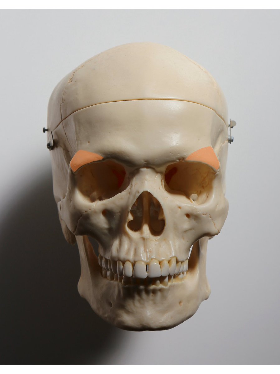 伊豆の美術解剖学者 前頭骨 の頬骨突起は前方に突出しているとはいえ 眼窩内側の眉間よりは後退している 仮に頬骨突起が眉間よりも前方に突出していた場合 横顔を見た時に眉間や鼻根が見えなくなってしまう