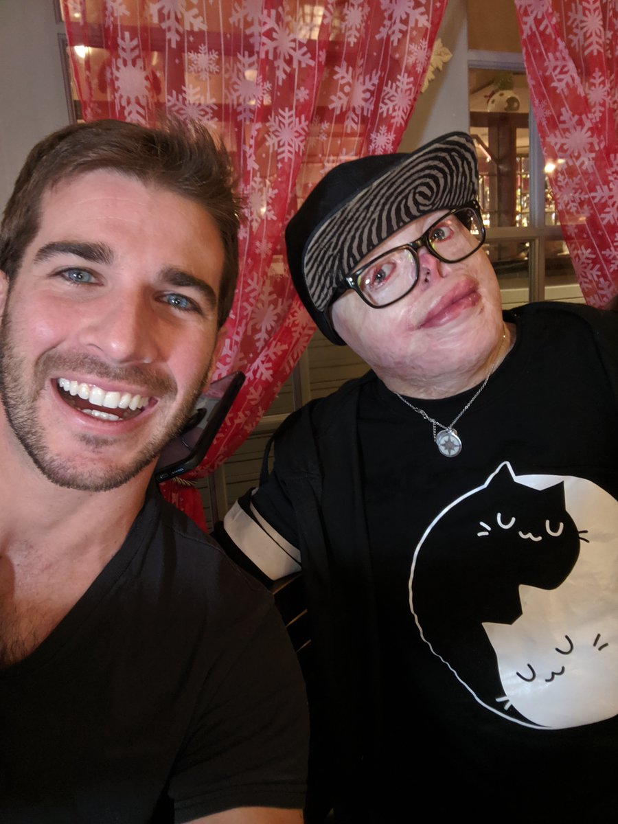 chrisulmer's tweet photo. Jadiant survived a fire and was put into a medically induced coma. Months later he awoke to a new reality in which others called him a “monster” and threw rocks at him. After years of struggle, Jadiant has learned to love himself. Full interview at https://t.co/lsuzrP0VXk. https://t.co/iNgmEVQ5xZ