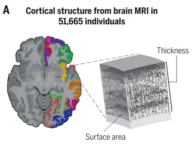 enigmabrains's tweet photo. Collaborative science is still crossing all borders: through the collaboration of hundreds of scientists worldwide we’ve identified genetic variants that impact cortical structure. Published in @ScienceMagazine: https://t.co/F3krKuMDDv (keep reading ↓) (1/9) https://t.co/z9gw12DI2G
