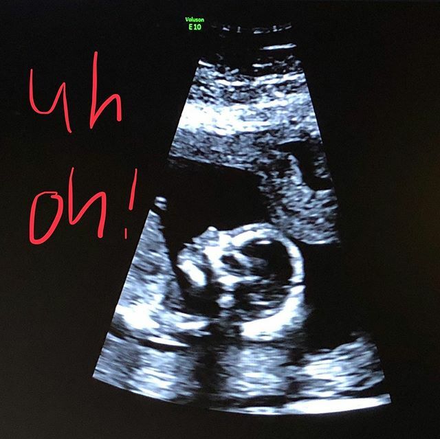 aj_shoots's tweet photo. Coming this September 🤭 https://t.co/DstSuBCtwx https://t.co/DEJ2ZWT4Ez