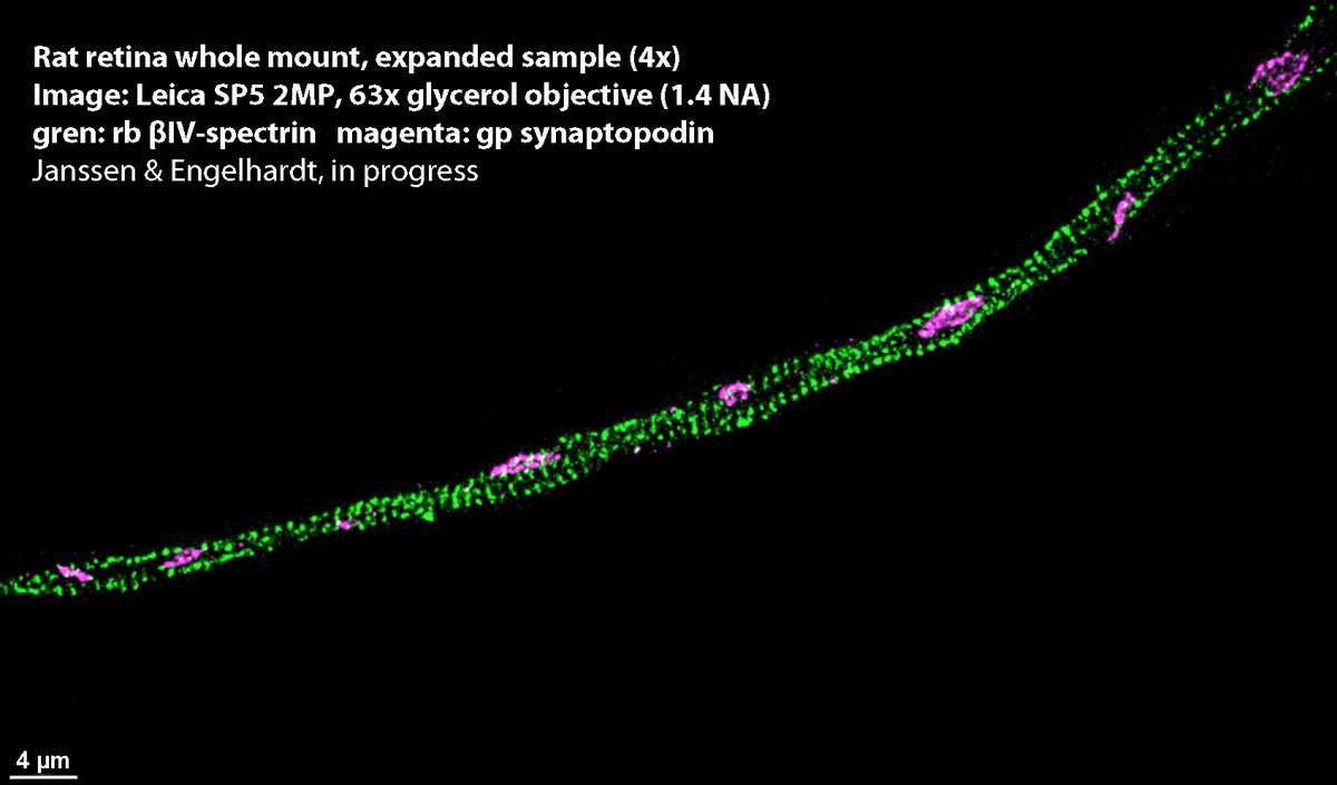 AxonalPlasticityLab (@axonallab) on Twitter photo First to go is <a href="/JMaxJanssen/">Maximilian Janssen</a>
- who has just spent 80 days studying for his M2 medical board exams, probably in vain as it now seems .... everything is cancelled. Good thing he got bored half way through and tried his hand at proEx microscopy. He just saved us a STED. First to go is <a href="/JMaxJanssen/">Maximilian Janssen</a>
- who has just spent 80 days studying for his M2 medical board exams, probably in vain as it now seems .... everything is cancelled. Good thing he got bored half way through and tried his hand at proEx microscopy. He just saved us a STED.