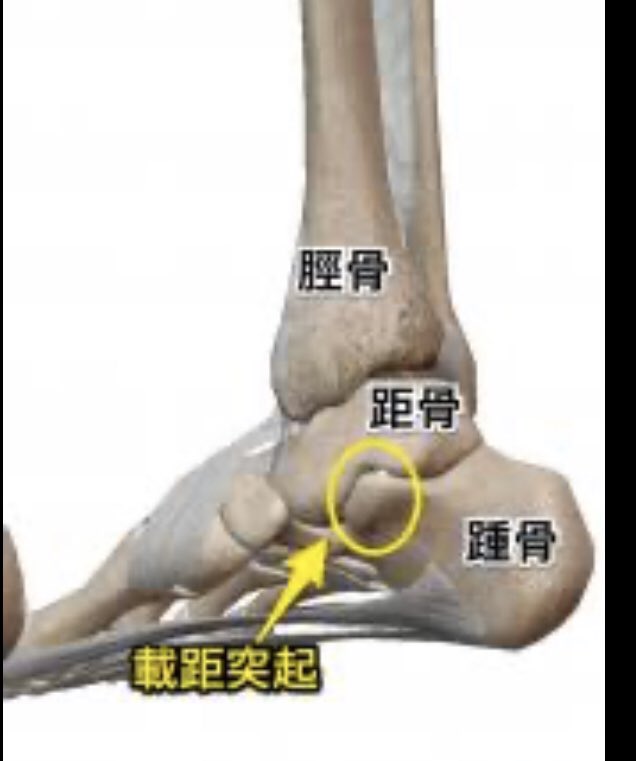 載距突起